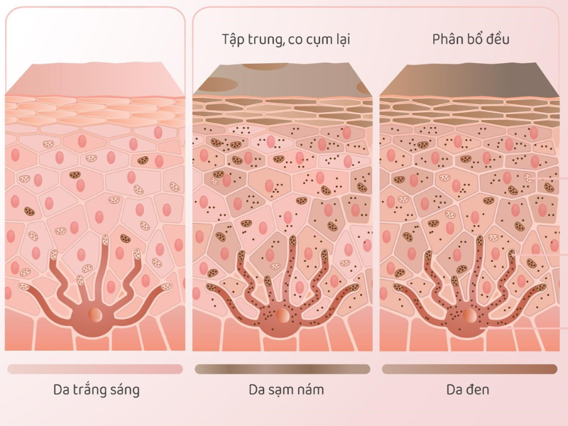 tong-hop-6-cach-uc-che-sac-to-melanin-hieu-qua-2