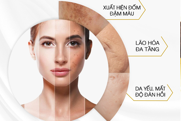 Dấu hiệu nám nội tiết