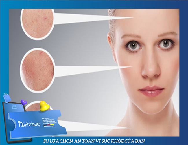 Da xuất hiện dấu hiệu lão hóa là biểu hiện cho thấy cơ thể bị suy giảm nội tiết