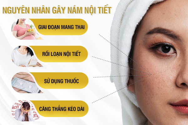 Nguyên nhân gây nám nội tiết