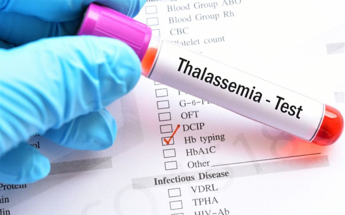 Gen bệnh Thalassemia (Tan máu bẩm sinh): Nguyên nhân, phòng ngừa và điều trị
