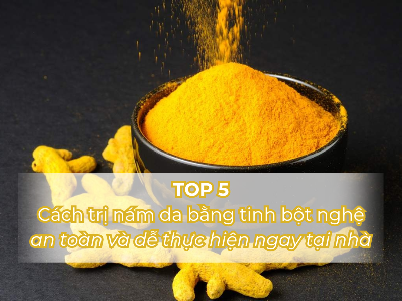 Top 5 cách trị nám da bằng tinh bột nghệ an toàn và dễ thực hiện ngay tại nhà