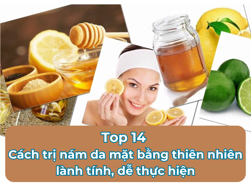 Top 13 cách trị nám da mặt bằng thiên nhiên lành tính, dễ thực hiện