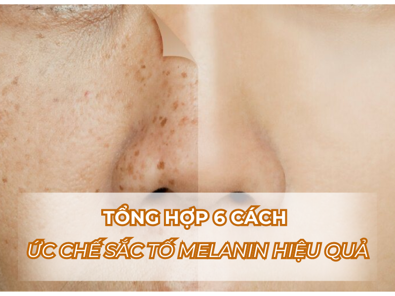 Tổng hợp 6 cách ức chế sắc tố Melanin hiệu quả