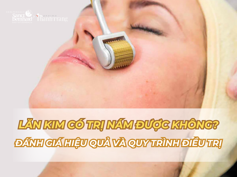 Lăn Kim Có Trị Nám Được Không? Đánh Giá Hiệu Quả và Quy Trình Điều Trị