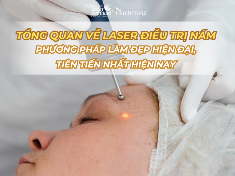 Tổng quan về Laser điều trị nám - Phương pháp làm đẹp hiện đại, tiên tiến nhất hiện nay