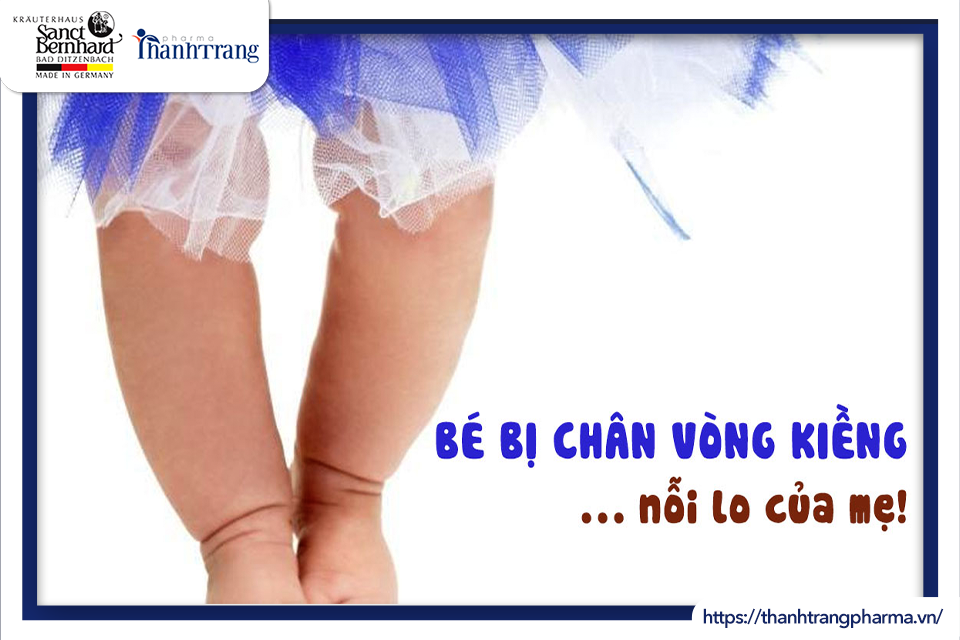 BA MẸ CẦN LÀM GÌ KHI BÉ BỊ CHÂN VÒNG KIỀNG