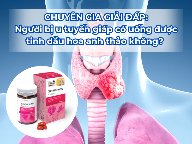 Người bị u tuyến giáp có uống được tinh dầu hoa anh thảo không? - Chuyên gia giải đáp