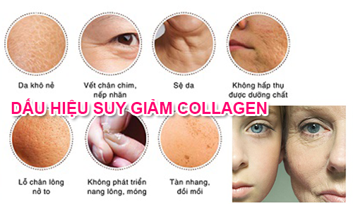 Nguyên nhân gây thiếu hụt collagen và cách khắc phục