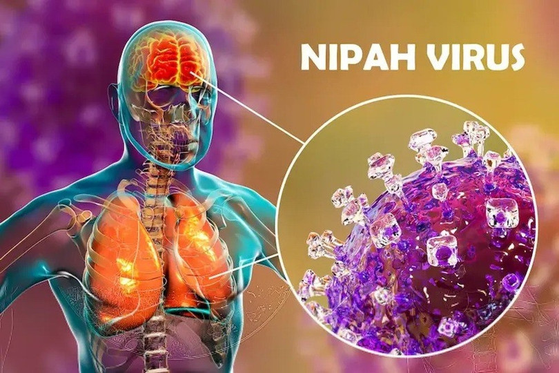 6 điều nên biết về virus Nipah