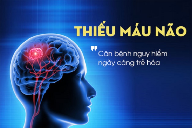 Giải đáp: Thiếu máu lên não nên ăn gì?